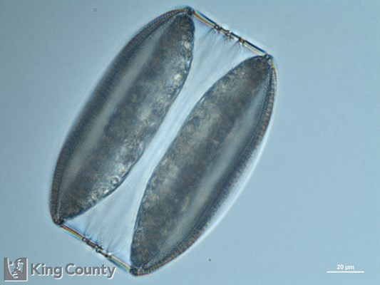 Photo of Coscinodiscus spp.